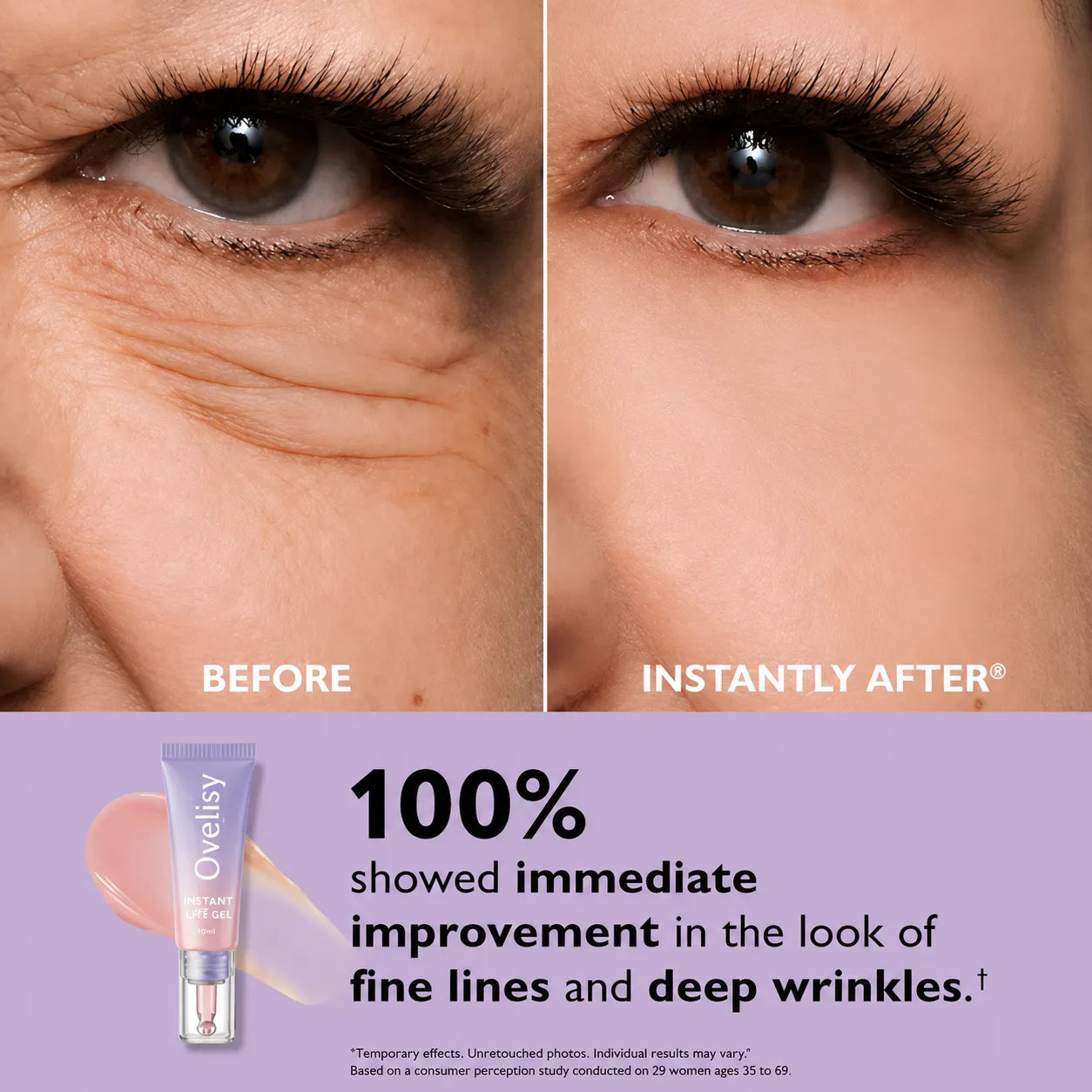 💥LAST DAY SALE-60% OFF- Ovelisy® Eye Bag Instant Eraser, Tightens, Firms, & Blurs Wrinkles