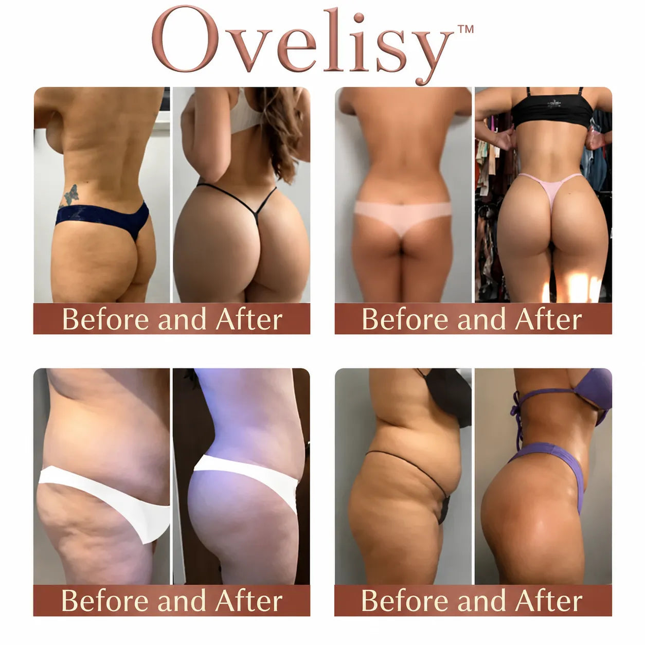 💥Selling out soon🔥- Ovelisy™ CurveSculpt Micro-Patch ✦ Sculpt • Firm • Smooth Lower Body Curves ✦ Micro-Needle Infusion System