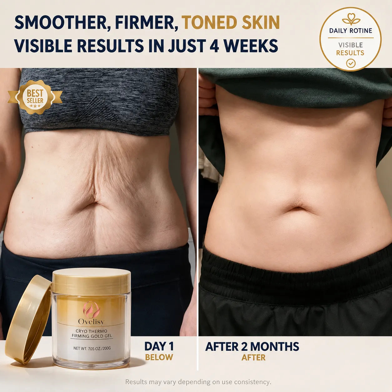 🔥Last Day 49% OFF Ovelisy™ Anti-Cellulite Body Cream