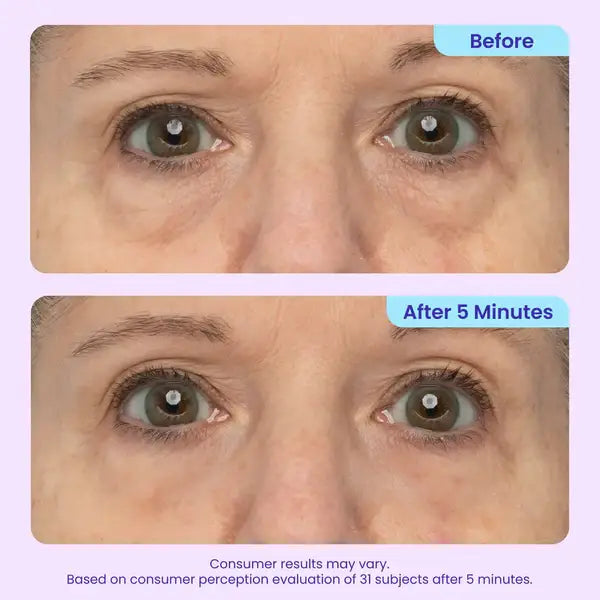 💥LAST DAY SALE-60% OFF- Ovelisy® Eye Bag Instant Eraser, Tightens, Firms, & Blurs Wrinkles