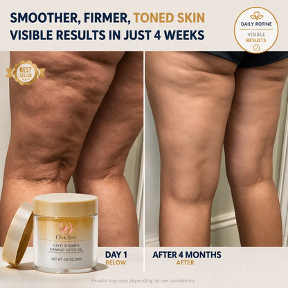 🔥Last Day 49% OFF Ovelisy™ Anti-Cellulite Body Cream