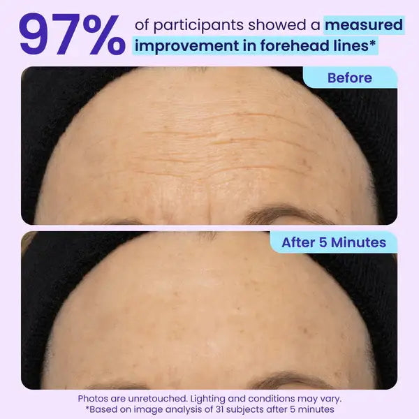 💥LAST DAY SALE-60% OFF- Ovelisy® Eye Bag Instant Eraser, Tightens, Firms, & Blurs Wrinkles