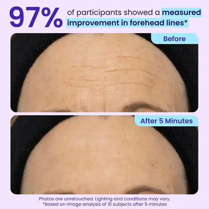 💥LAST DAY SALE-60% OFF- Ovelisy® Eye Bag Instant Eraser, Tightens, Firms, & Blurs Wrinkles