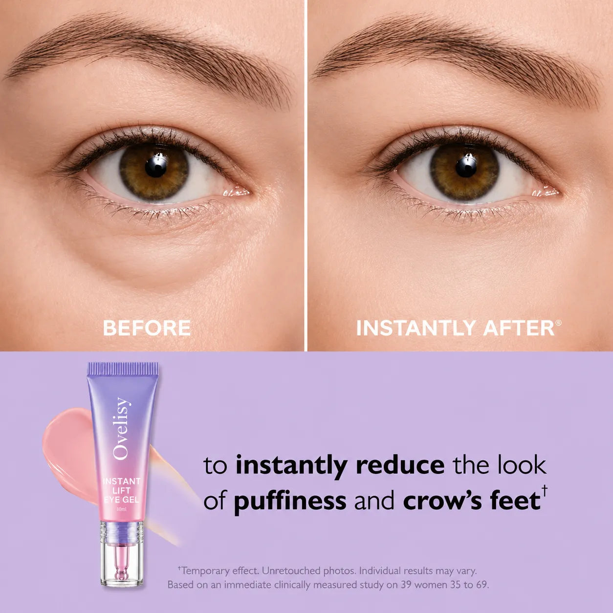 💥LAST DAY SALE-60% OFF- Ovelisy® Eye Bag Instant Eraser, Tightens, Firms, & Blurs Wrinkles