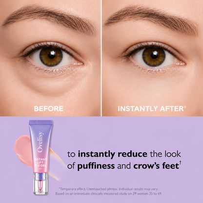 💥LAST DAY SALE-60% OFF- Ovelisy® Eye Bag Instant Eraser, Tightens, Firms, & Blurs Wrinkles
