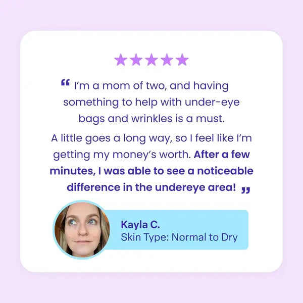 💥LAST DAY SALE-60% OFF- Ovelisy® Eye Bag Instant Eraser, Tightens, Firms, & Blurs Wrinkles