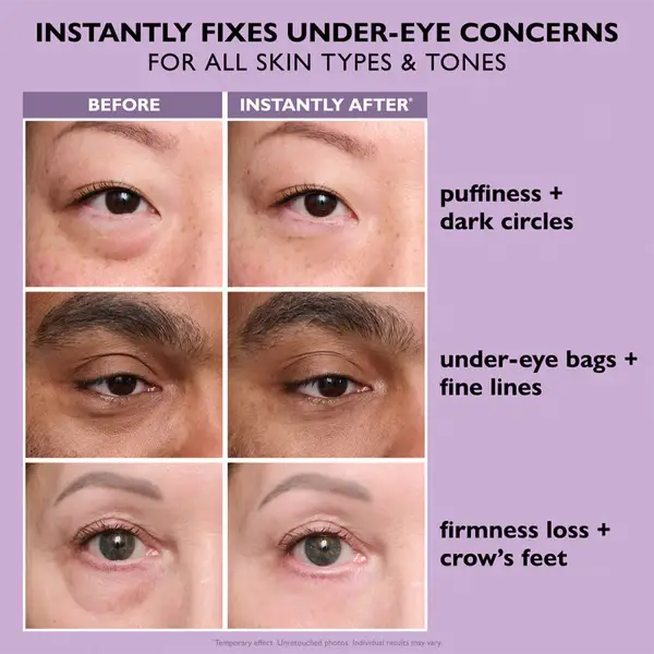 💥LAST DAY SALE-60% OFF- Ovelisy® Eye Bag Instant Eraser, Tightens, Firms, & Blurs Wrinkles